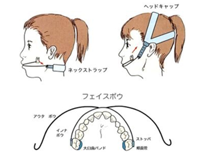 ヘッドギア